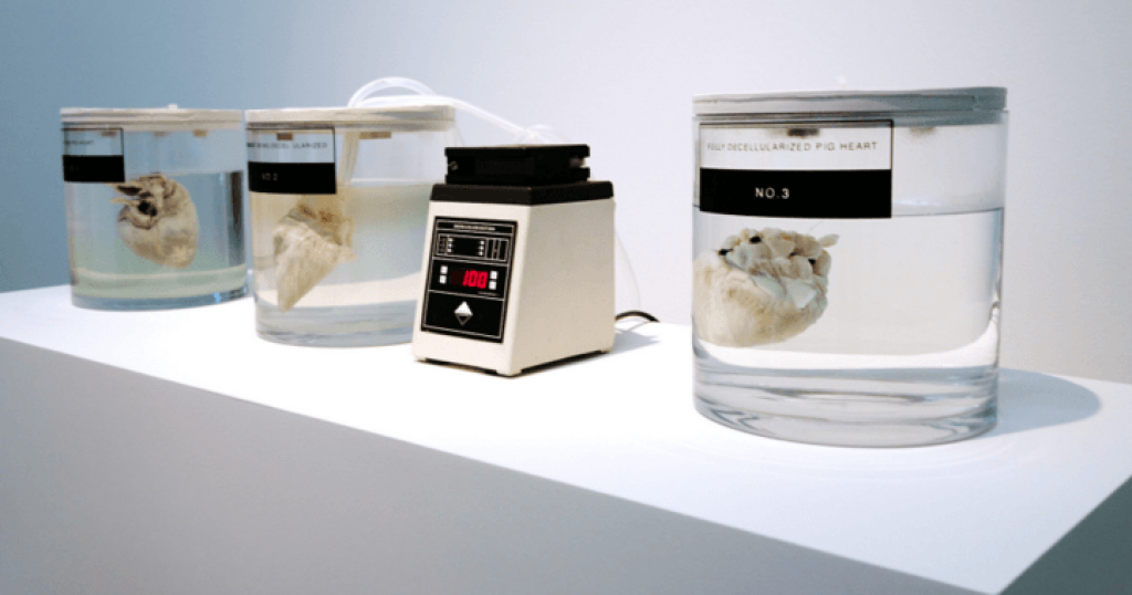 Can organs be objects of design?
